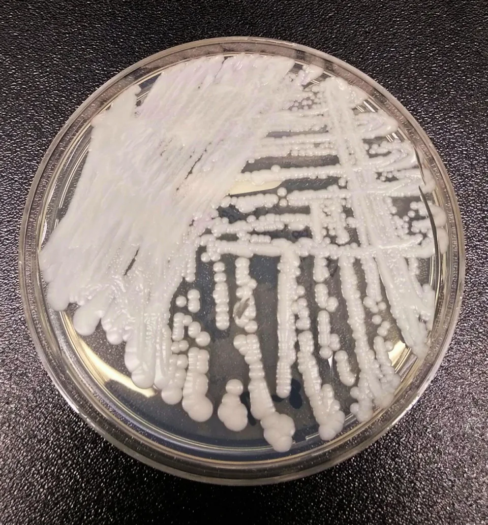 US: What You Need To Know About Deadly Fungal Infection Spreading In Hospitals – CDC Here’s what to know.
